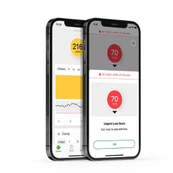 Two smartphone screens showing the Dexcom G7 app with glucose graphs and urgent low alerts for hypoglycemia