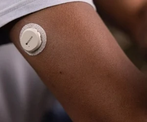 Close-up of a Dexcom G7 continuous glucose monitor sensor attached to a person's upper arm